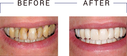 Family Dentist in Fair Oaks