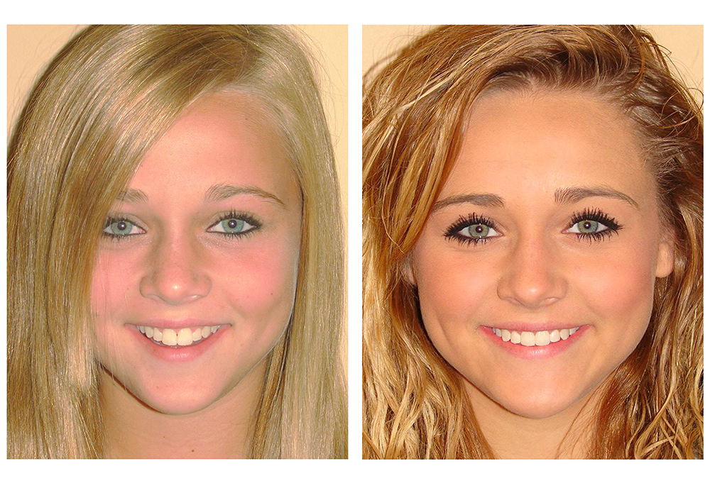 My Tooth Spa Dentistry   Orthodontics