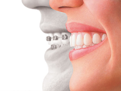 My Tooth Spa Dentistry   Orthodontics | Implant Dentistry, All-on-4 reg  and Sports Mouthguards