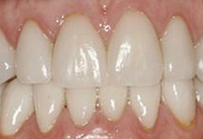 My Tooth Spa Dentistry   Orthodontics | Crowns  amp  Caps, Extractions and Laser Dentistry