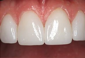 My Tooth Spa Dentistry   Orthodontics | Periodontal Treatment, Cosmetic Dentistry and Dental Fillings