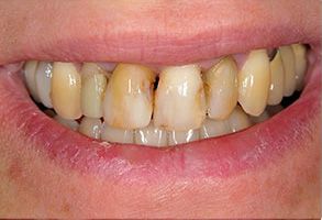 My Tooth Spa Dentistry   Orthodontics | Laser Dentistry, Oral Cancer Screening and Veneers