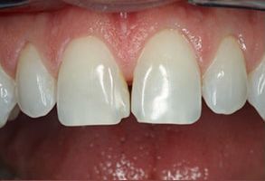 My Tooth Spa Dentistry   Orthodontics | Periodontal Treatment, Sedation Dentistry and Extractions